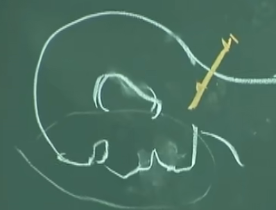 image-20230513152458426